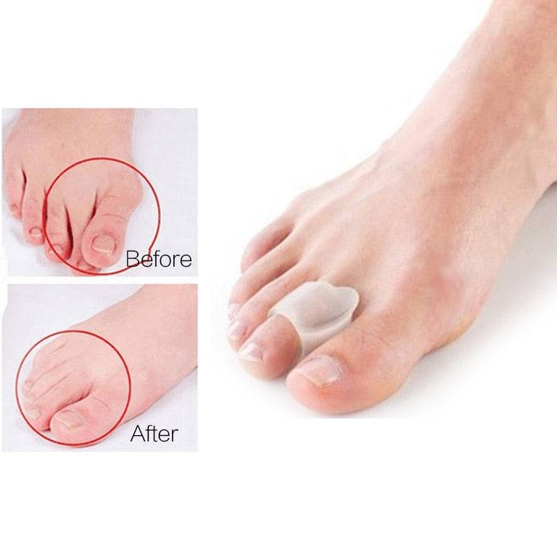 Big Toe Straightener Thumb Valgus Protector Silicone Gel Foot Fingers Toe Separator Bunion Adjuster Feet Pads Relief Foot Pain - Quid Mart